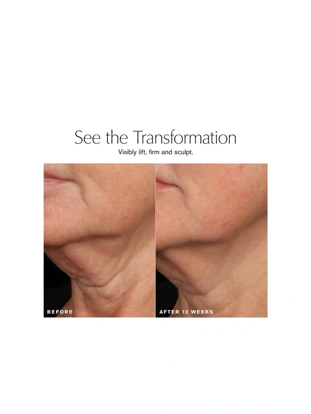 Estee Lauder 5d facelift